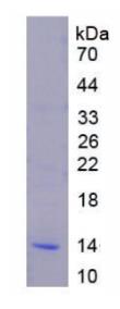 SDS-PAGE (STAT3-31H).jpg